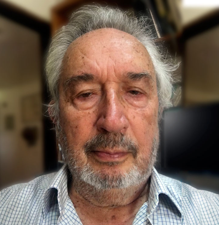 Hérnan Durán